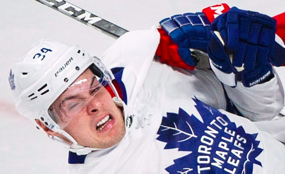 Auston Matthews a une épaule en COMPOTE...Depuis qu'il est ADOLESCENT...