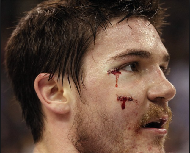 Même le Columbus Dispatch affirme que le contrat d'Andrew Shaw est le PIRE de la LNH...