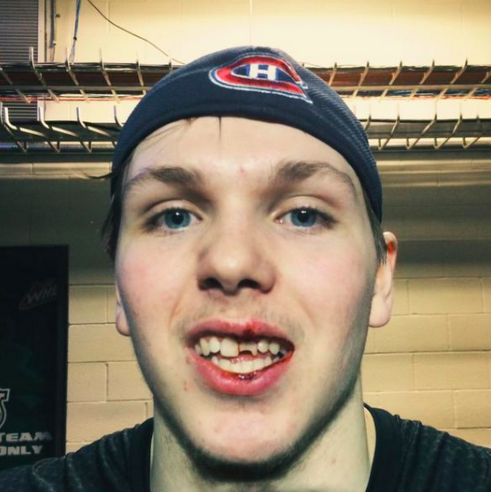  Nikita Scherbak est un LÂCHE...