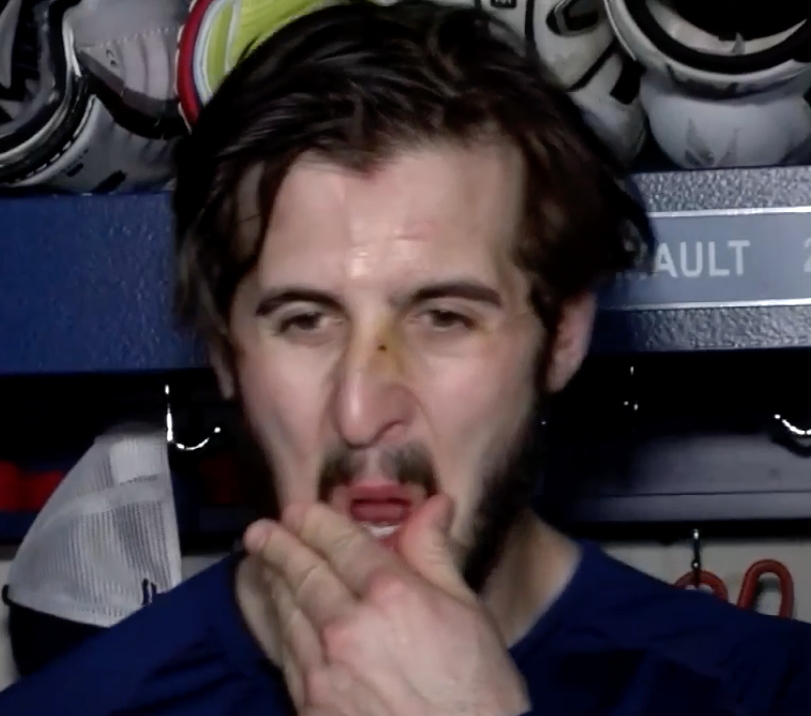 Phil Danault a le nez EXPLOSÉ !!!