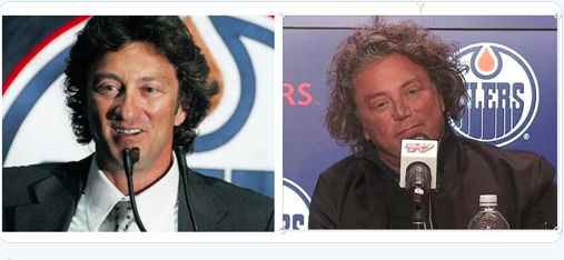 Le proprio des Oilers, Darryl Katz, a eu une CHIRURGIE PLASTIQUE?????