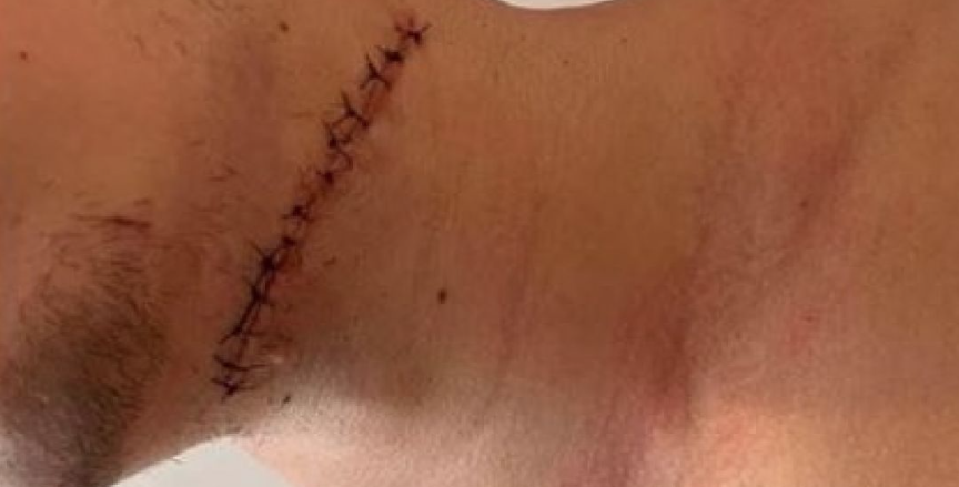 Les détails commencent à émerger sur l'AGRESSION dont a été victime le frère de Samuel Poulin.