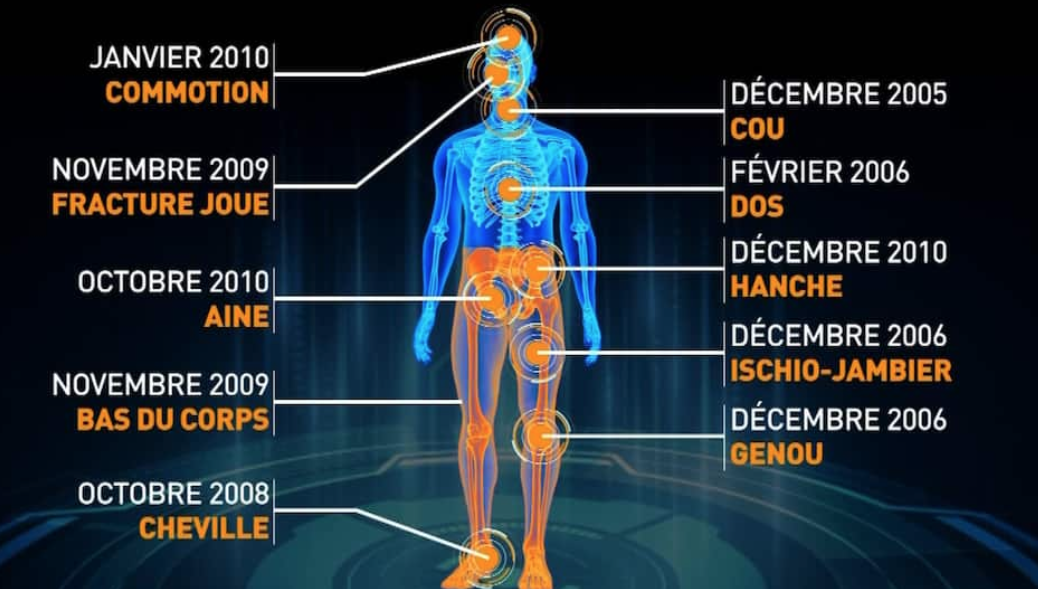 Le corps de Brendan Gallagher à 38 ans...OUCH....