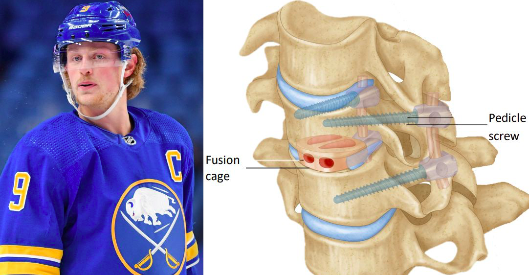 La BLESSURE de Jack Eichel fait PEUR en SALE...