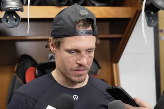 L'entrevue de la honte: Nick Cousins choque avec son visage tuméfié