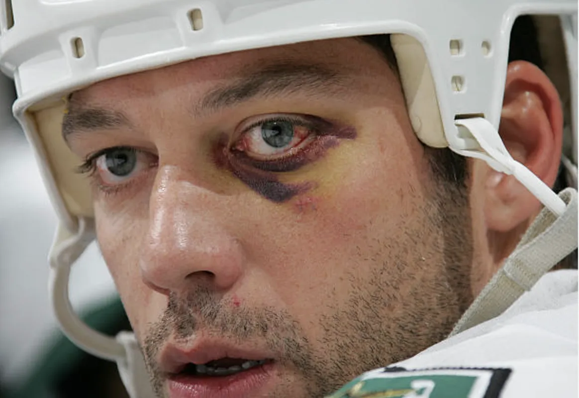 Une vidéo embarrassante refait surface : Bill Guerin exposé