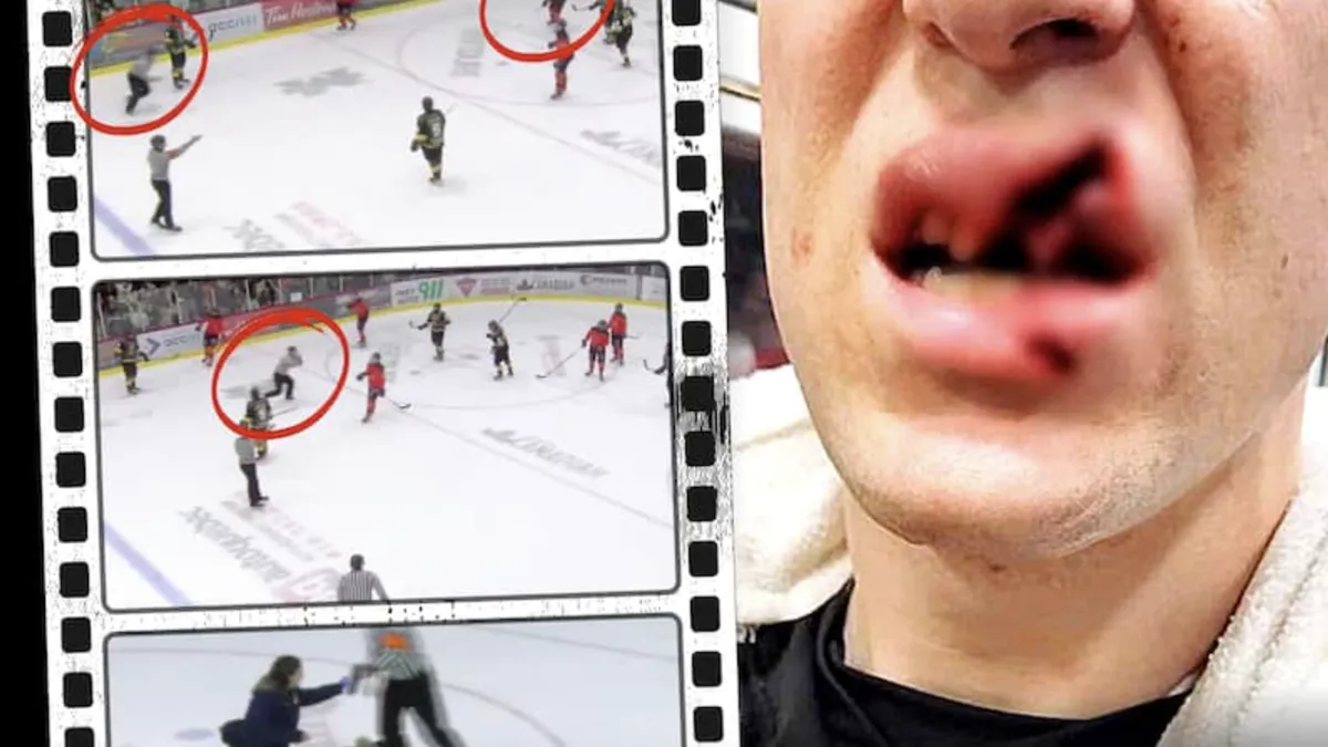 Histoire horrible: une blessure à 200 000 dollars