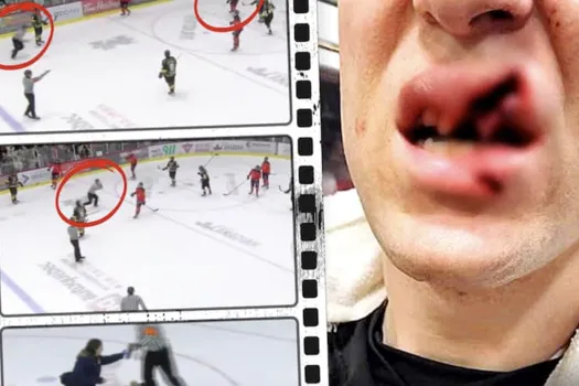 Histoire horrible: une blessure à 200 000 dollars