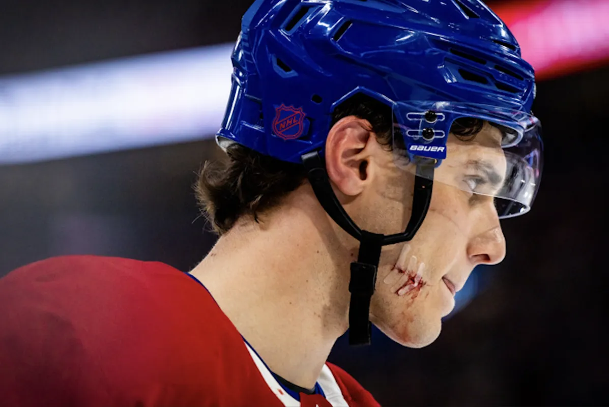 80 millions de dollars: Juraj Slafkovsky rejette la jalousie