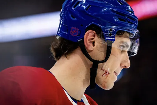 80 millions de dollars: Juraj Slafkovsky rejette la jalousie
